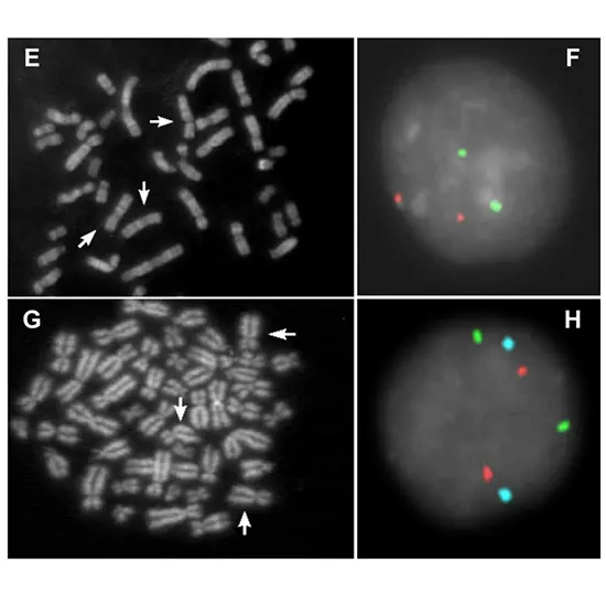 FISH and Chromosomes Analysis, Amniotic Fluid